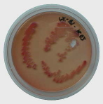 Petrischale mit McConkey-Agar